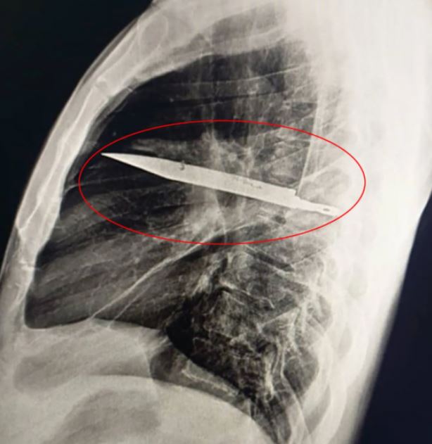 السكين تظهر فى الاشاعات