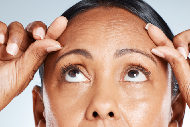 تجاعيد البشرة 