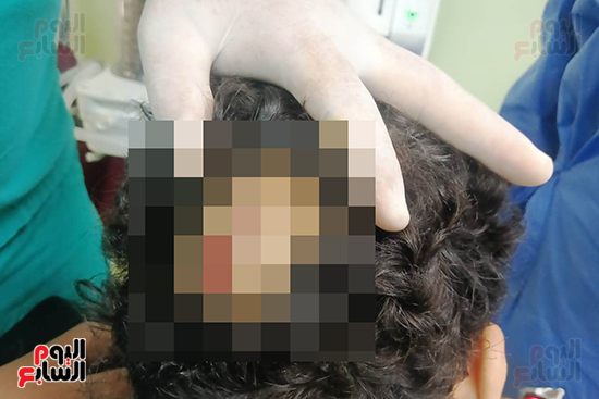 أصناء-الجراحة