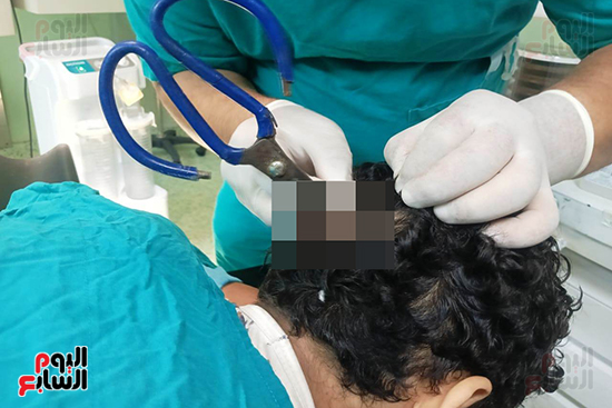 إزالة-الشعر-بمنطقة-الجراحة