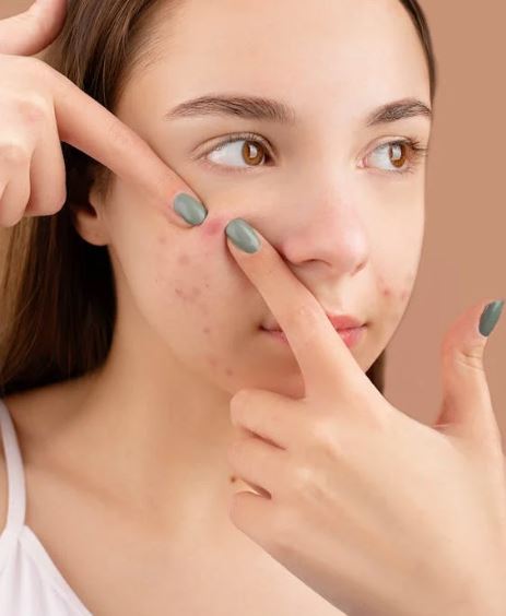 التخلص من البقع الداكنة