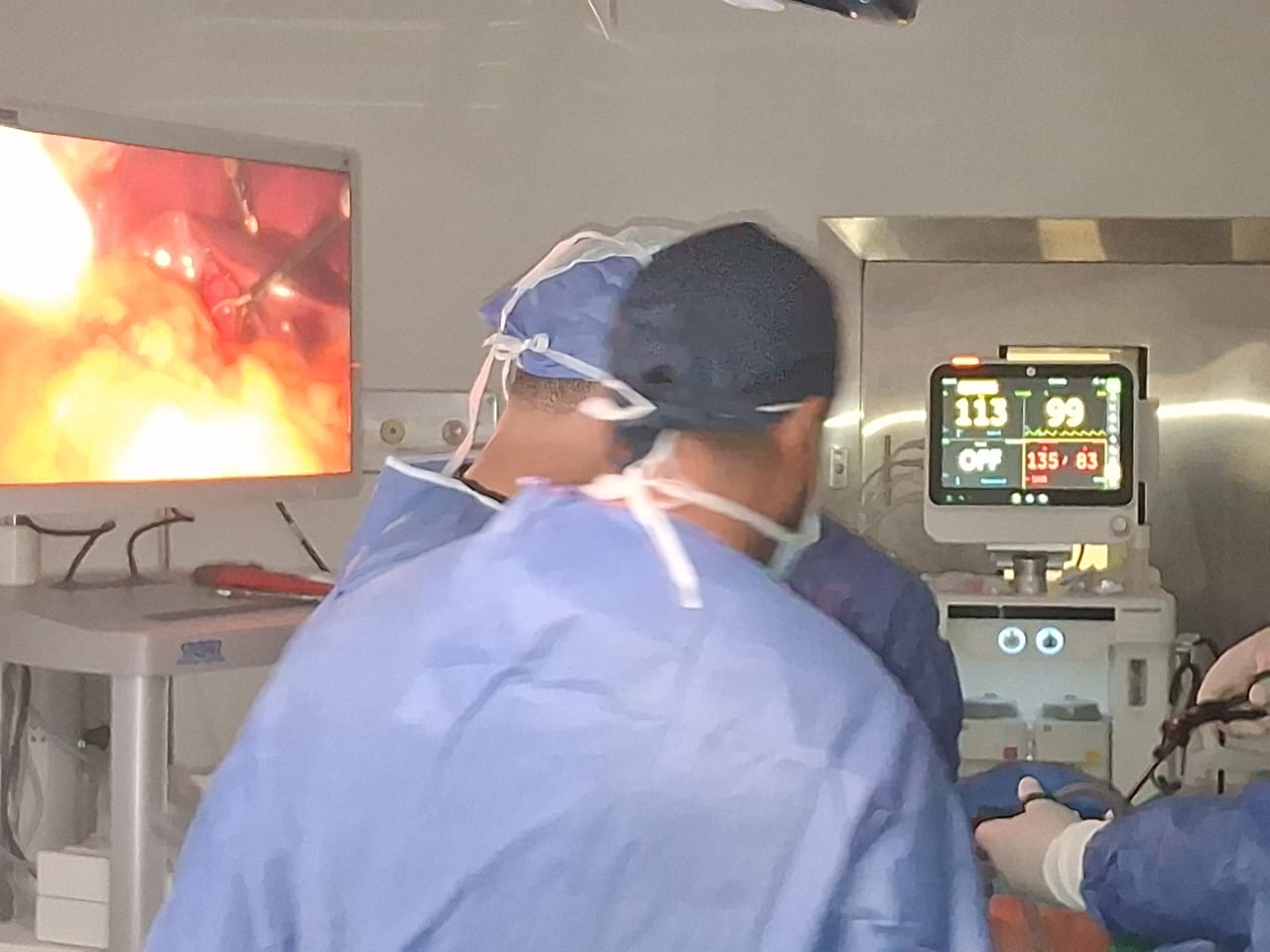 بدء التشغيل الرسمي لوحدة مناظير الجراحة