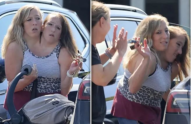 التوأمتان الملتصقتان