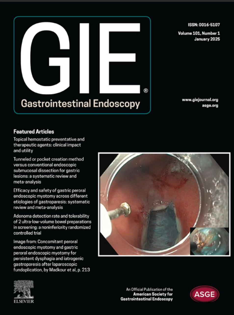 ابتكارات المناظير ابتكارات المناظير