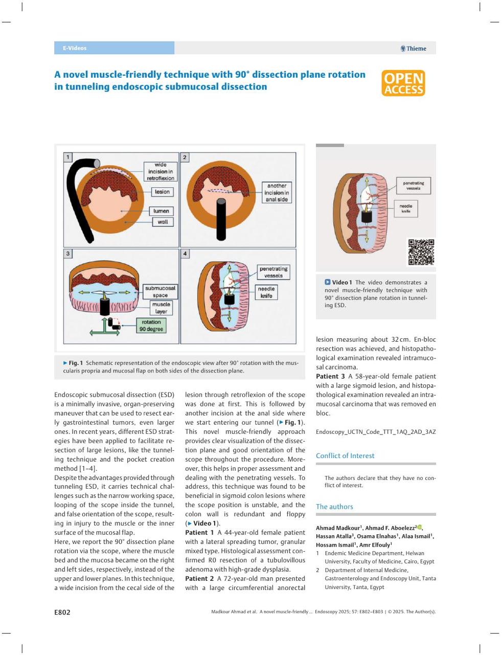 الإنجاز الإنجاز