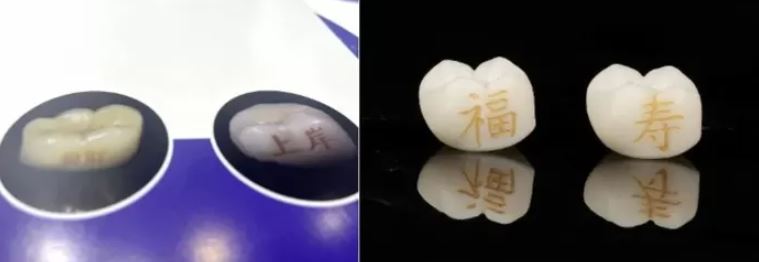 تاتو الأسنان