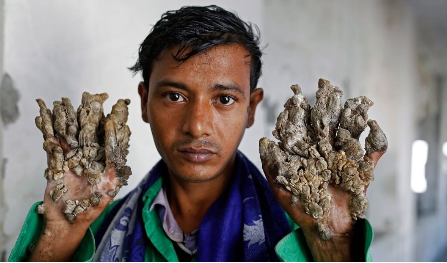 الرجل الشجرة