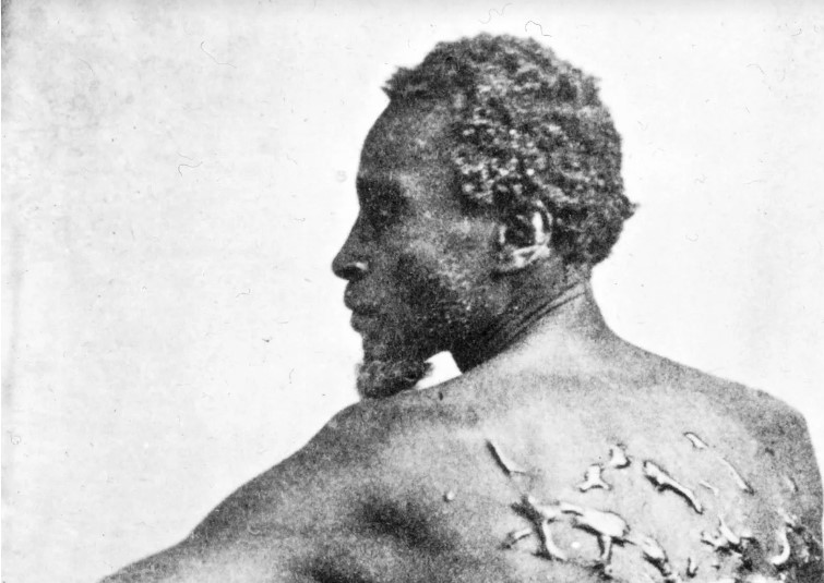 لوحة الظهر المجلود