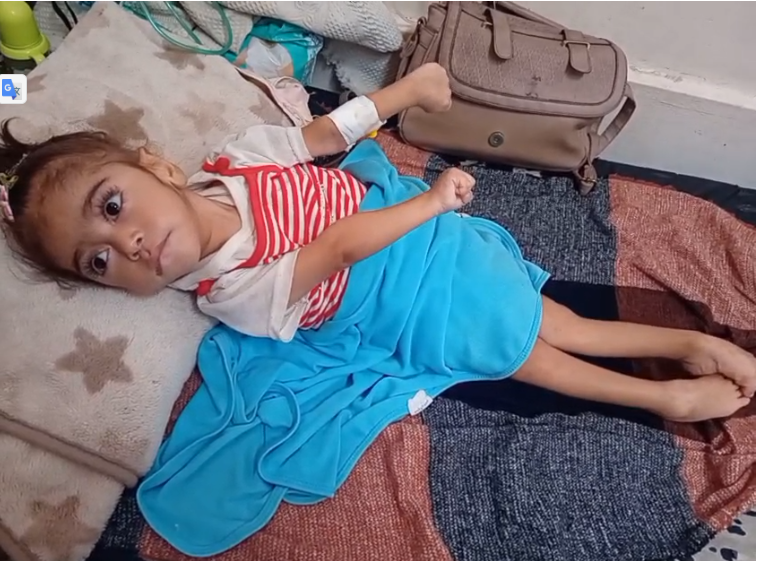 مريم بعد سوء التغذية