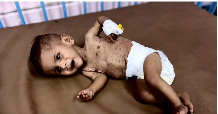 الطفل على أبو عاذرة