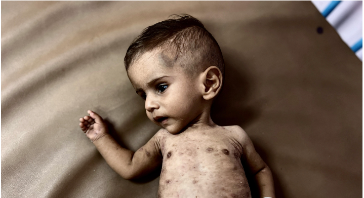 على أبو عاذرة