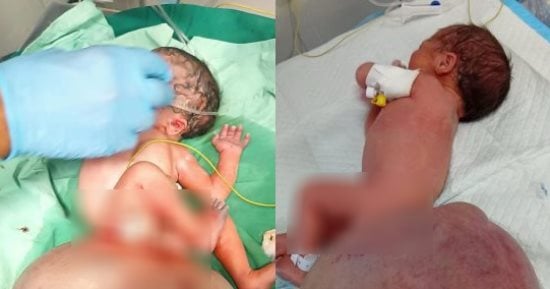الطفلة ضحية انتهاكات الاحتلال