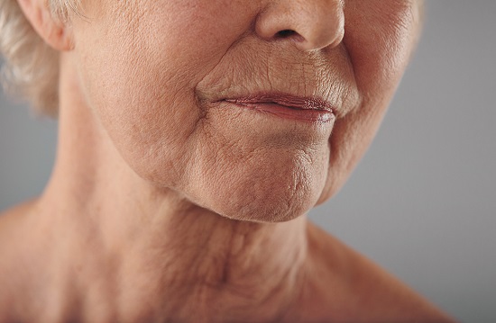 شيخوخة البشرة