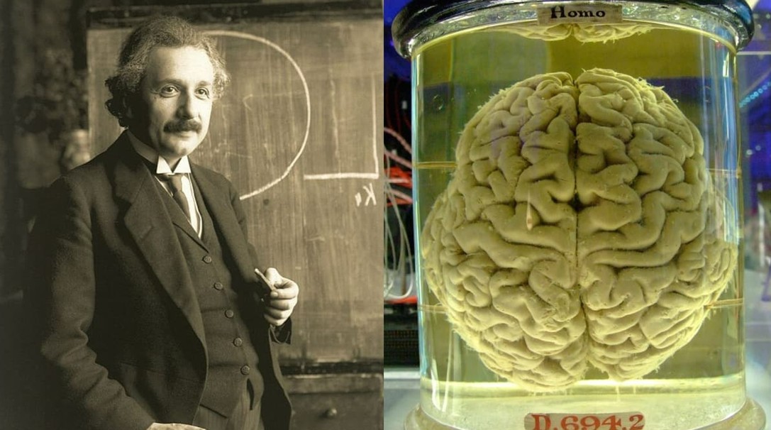 دماغ أينشتاين دماغ أينشتاين