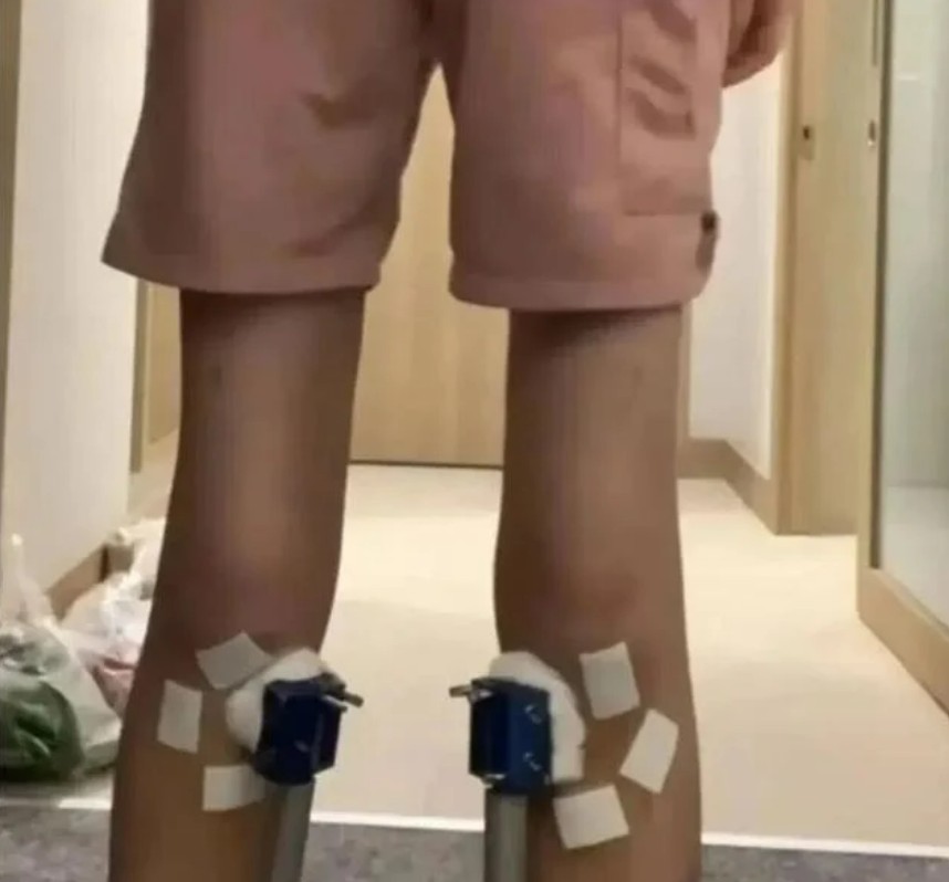 أثر العملية أثر العملية