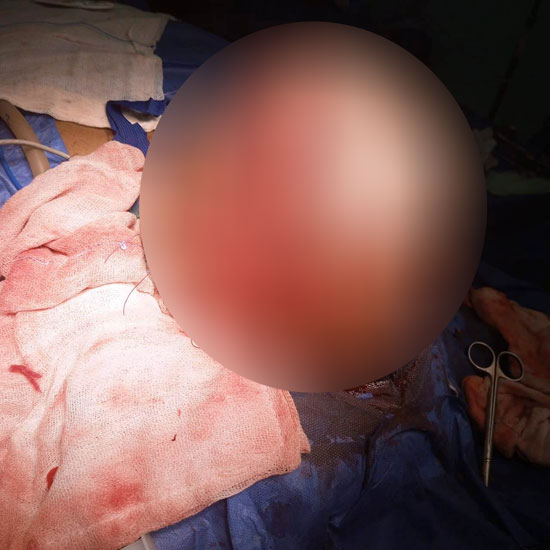 228651-ععععععع 228651-ععععععع