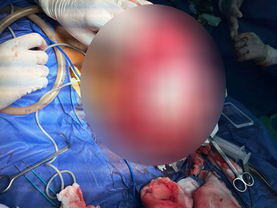 322847-عععع 322847-عععع