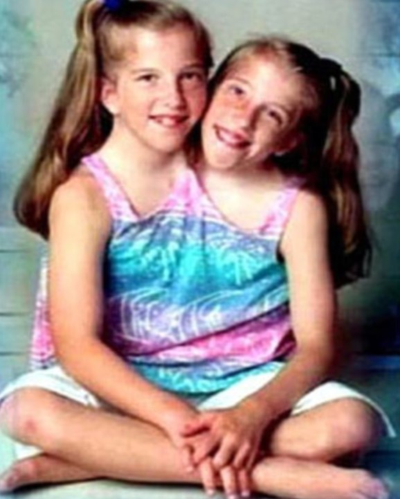 التوأم فى فترة طفولتهما