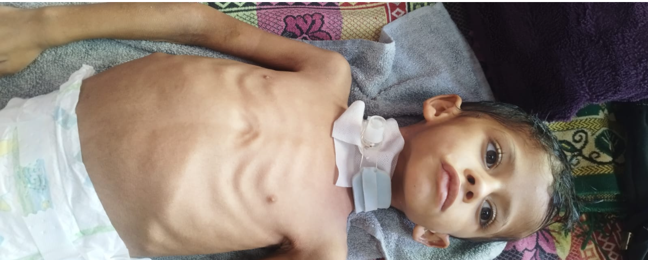 الطفل نائل شلبي