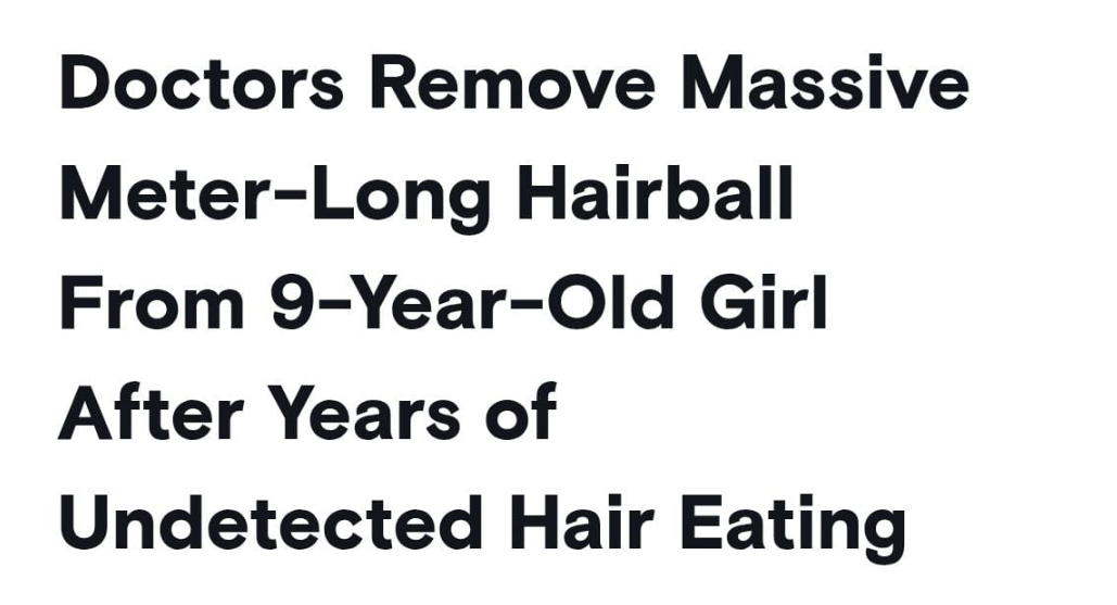 ازالة كرة شعر من بطن طفلة مصابة بداء أكل الشعر