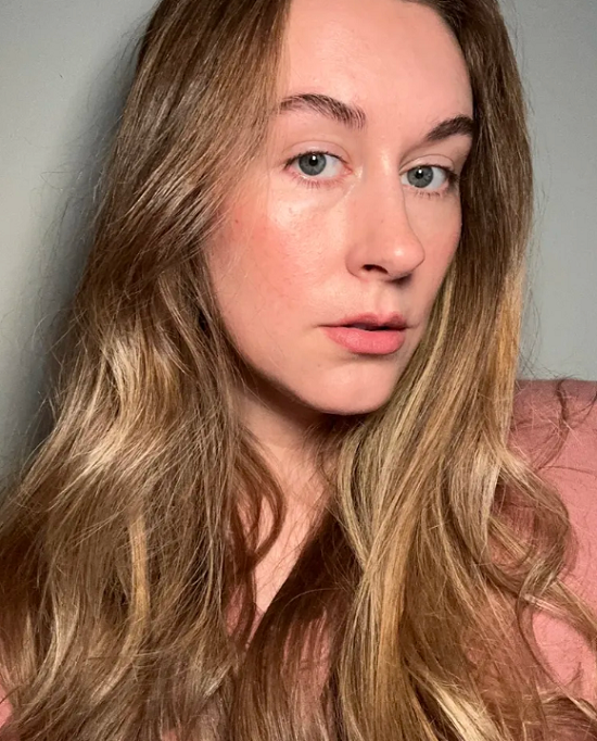 تساقط الرموش