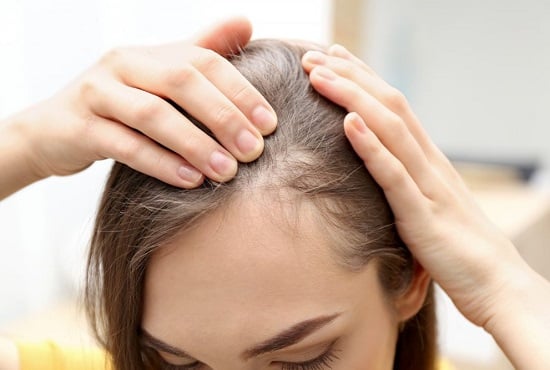 علاج تساقط الشعر