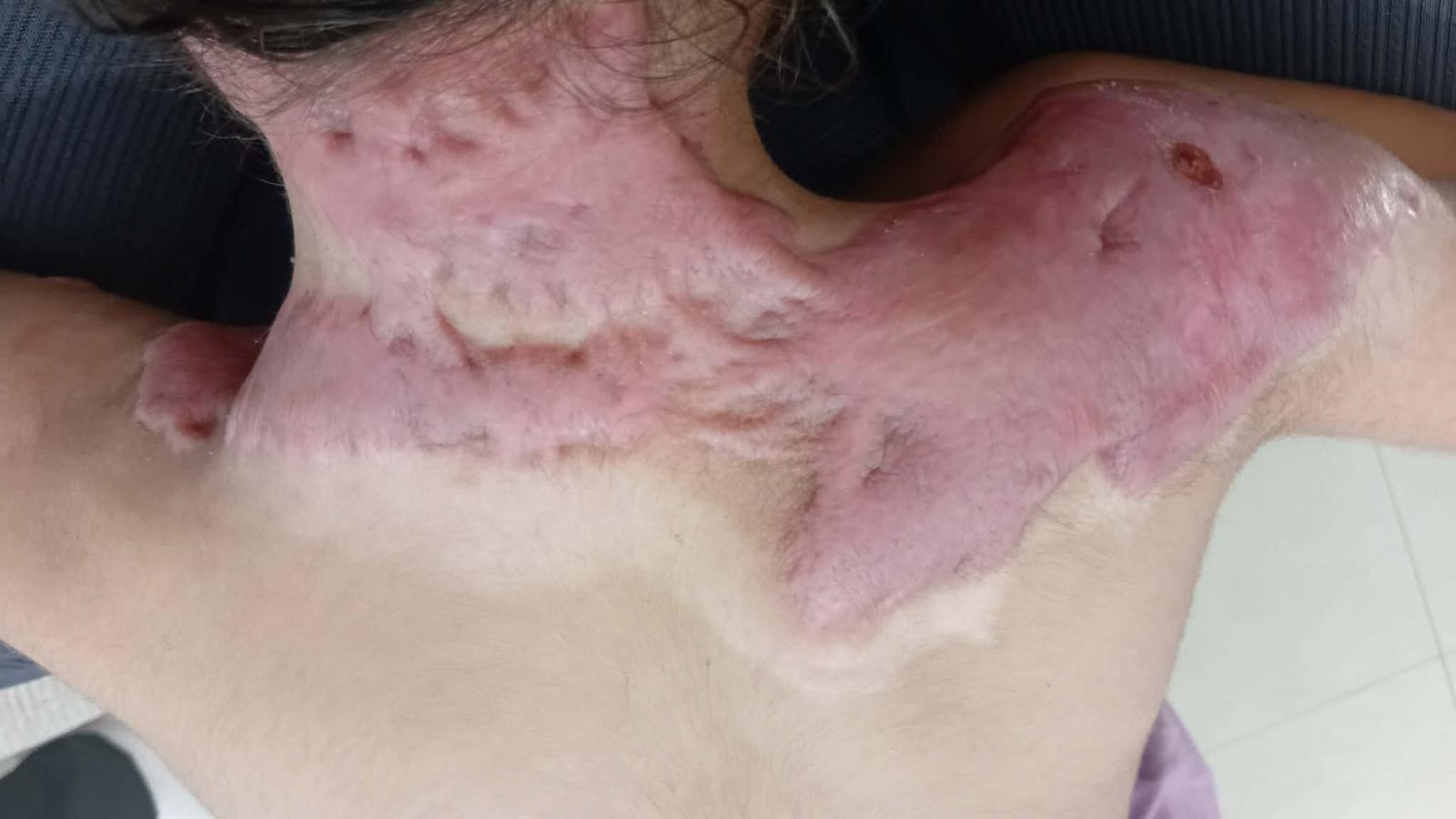 إصابة شهد الباز