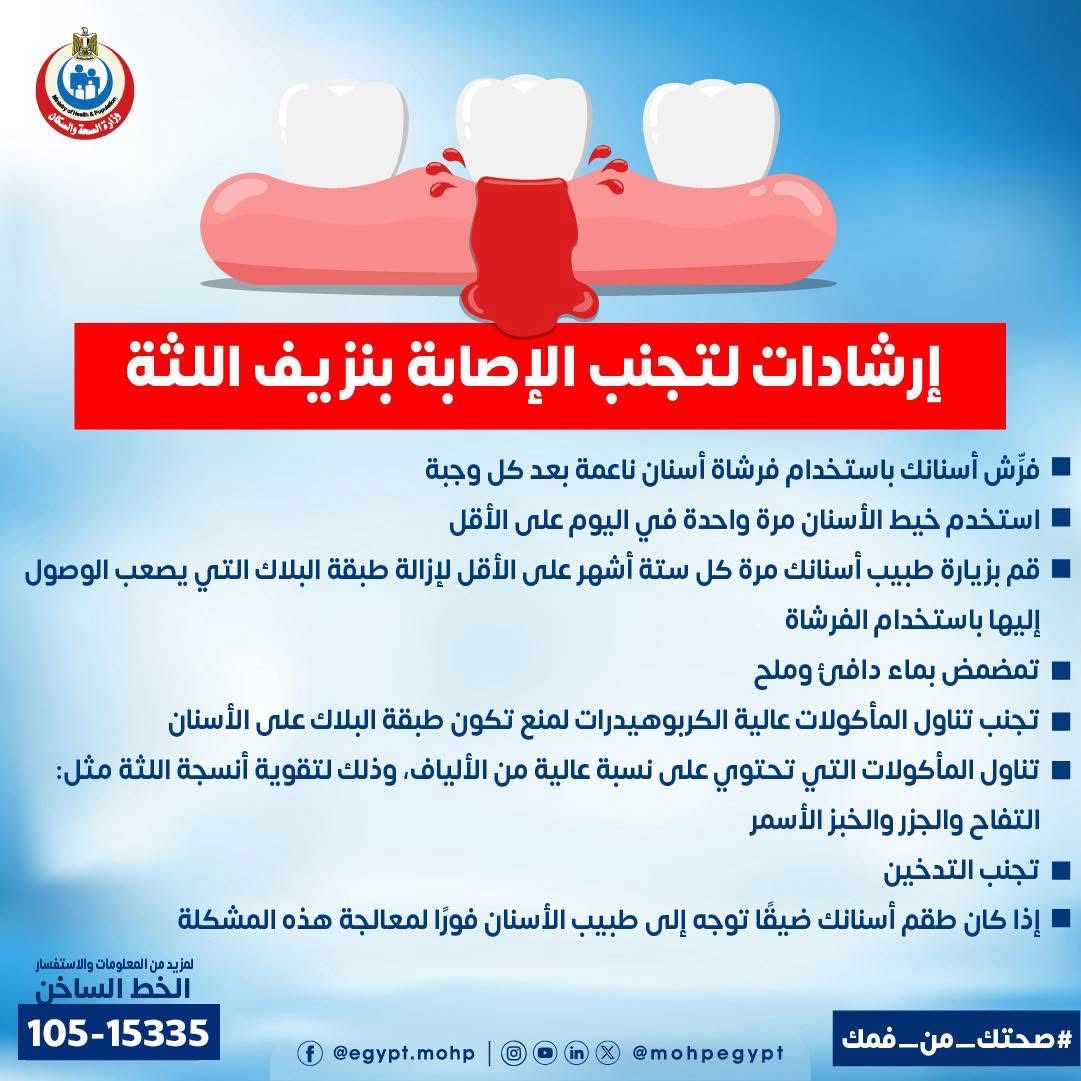  نصائح لتجنب الإصابة بنزيف اللثة