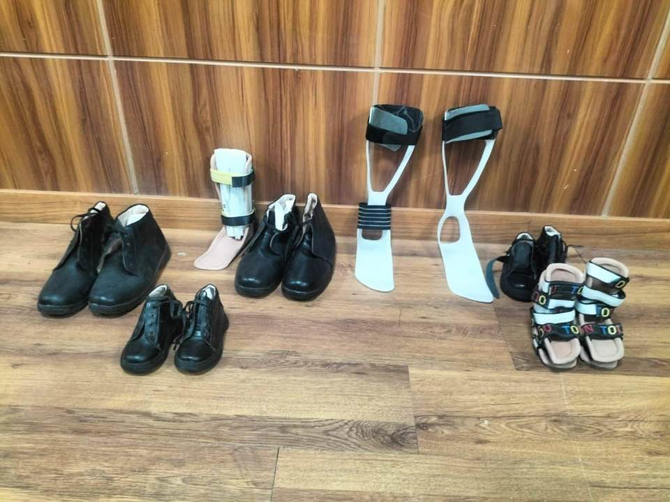 تواصل دعم خدمات الأجهزة التعويضية بمستشفى الكرنك الدولى