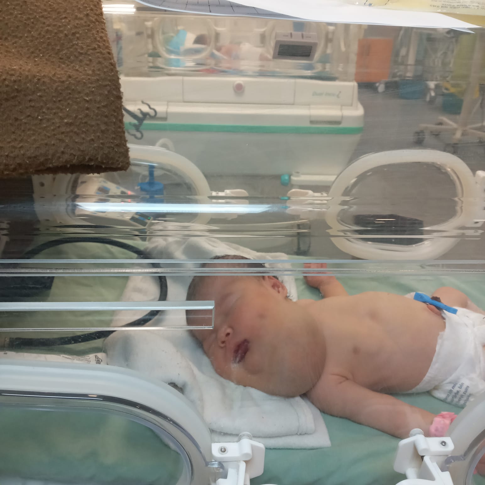 الطفلة حور العين قشطة الطفلة حور العين قشطة