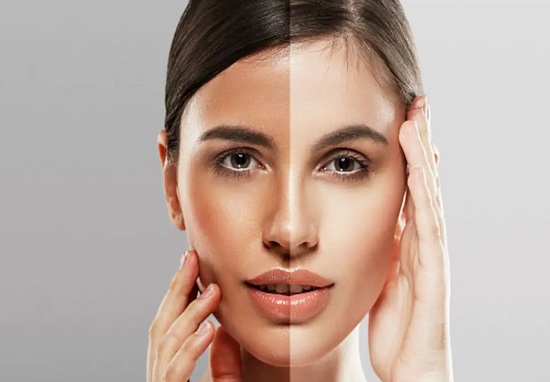 طرق طبيعية لتفتيح لون البشرة 