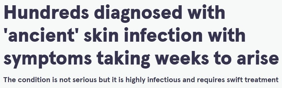 تحذيرات فى المملكة المتحدة من مرض جلدى شديد العدوى.. ما هو