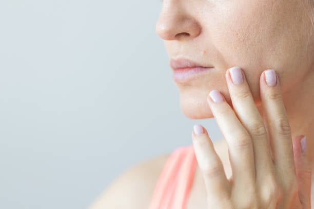 تقليل المسام تقليل المسام