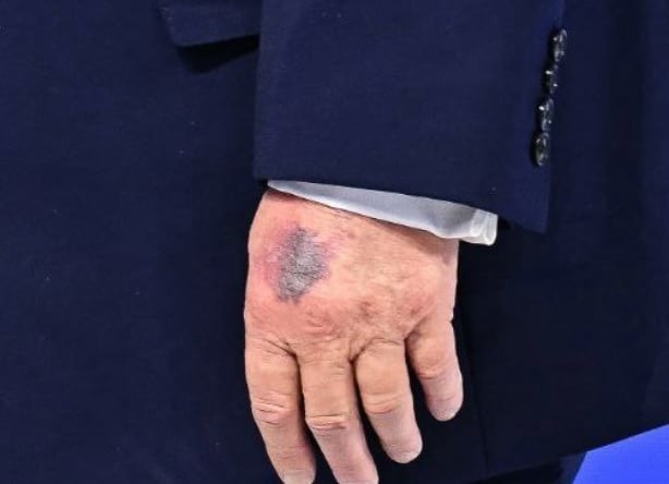 ترامب 99 ترامب 99