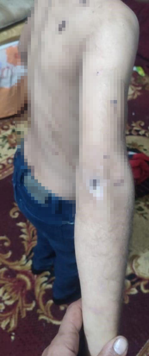 زوجة أب تحول منزلها إلى جحيم لطفل زوجها فى الفيوم