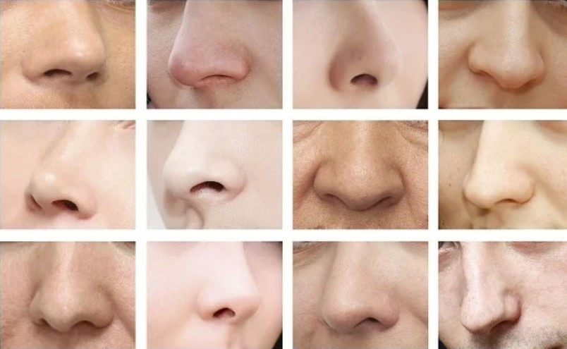 أشكال الأنف