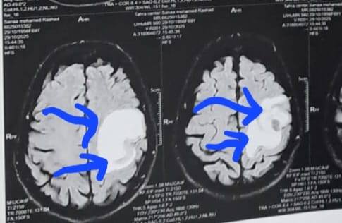الأشعة الخاصة بالمريضة الأشعة الخاصة بالمريضة