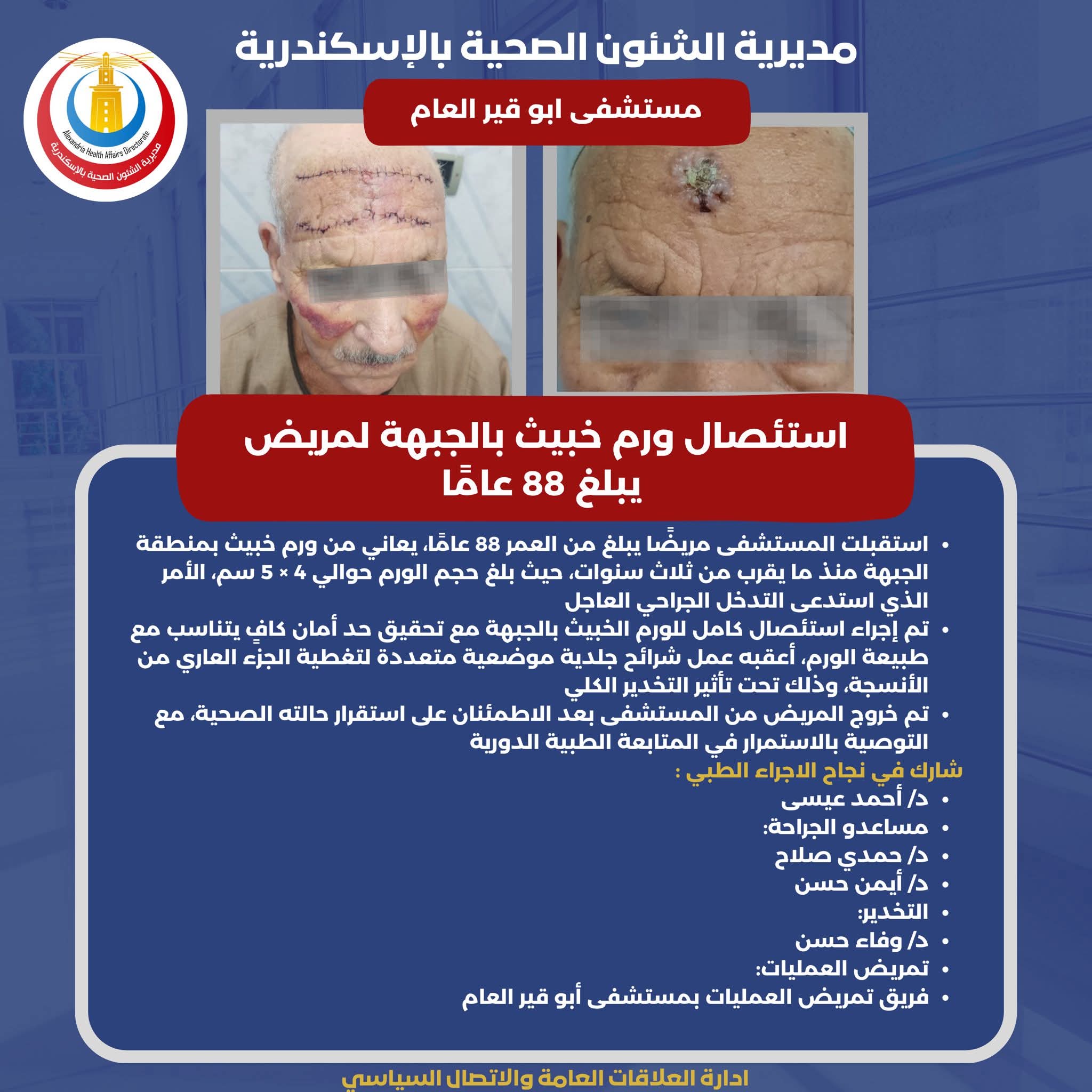 نجاح عملية استئصال ورم خبيث بالجبهة لمريض يبلغ 88 عاما