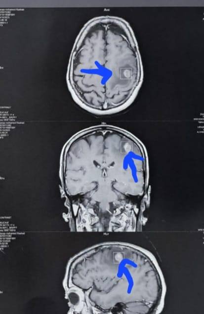 الأشعة الأشعة