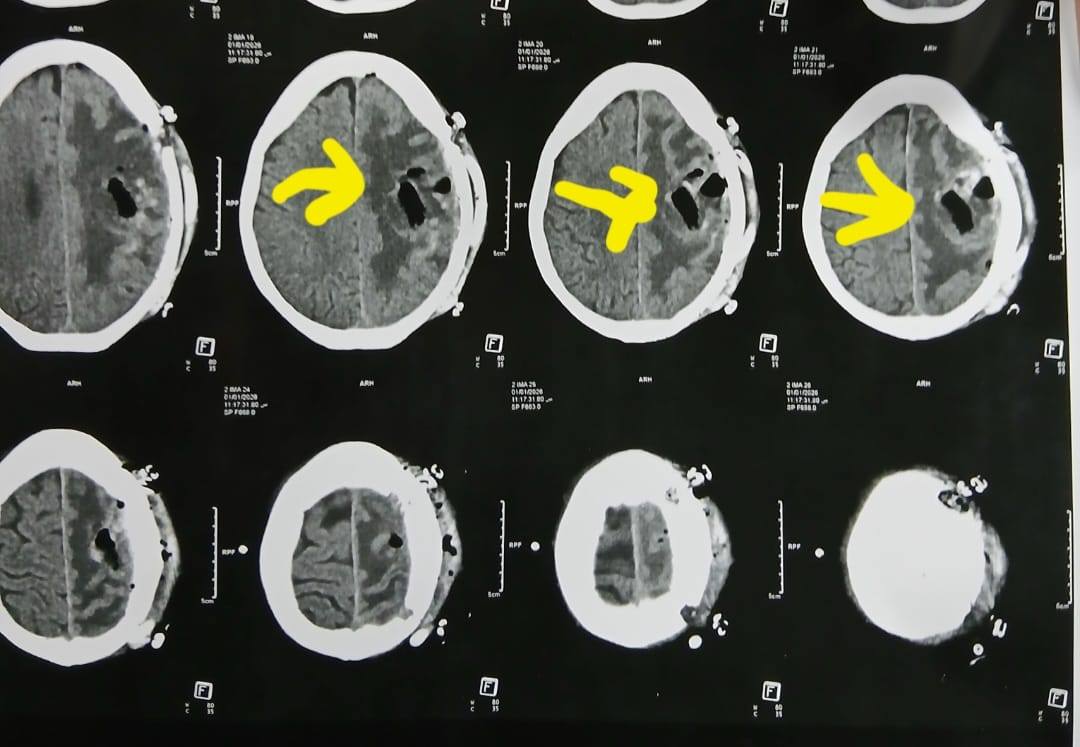 أشعة المريضة أشعة المريضة