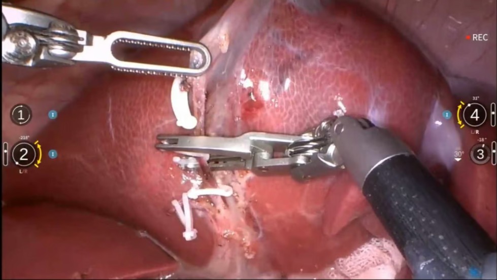 روبوت صينى يجرى جراحة معقدة على خنزير دون تدخل بشرى