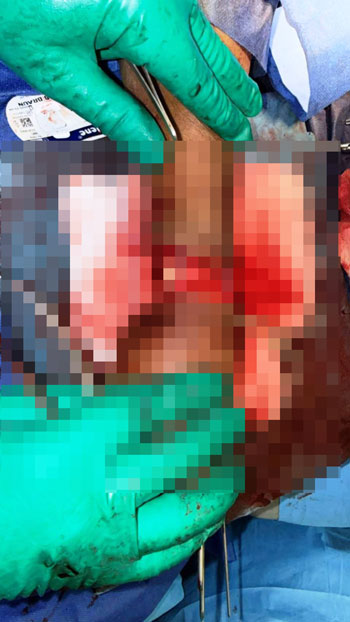 جانب من الجراحة جانب من الجراحة