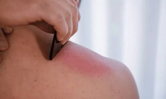 طريقة علاج قديمة
