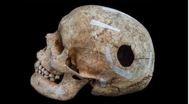 عملاق برأس مثقوب