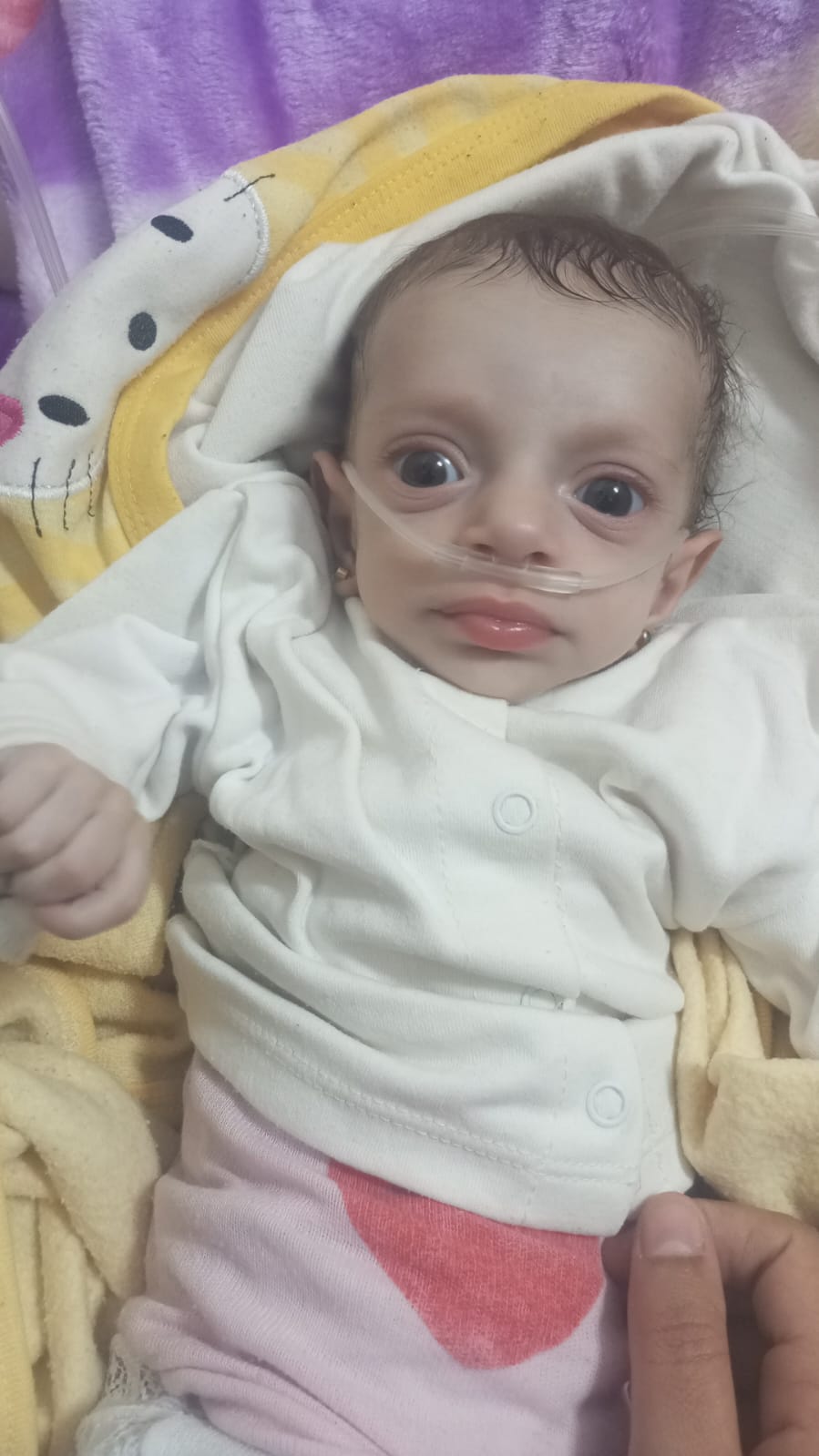 الطفلة ألما أبو ريدة الطفلة ألما أبو ريدة