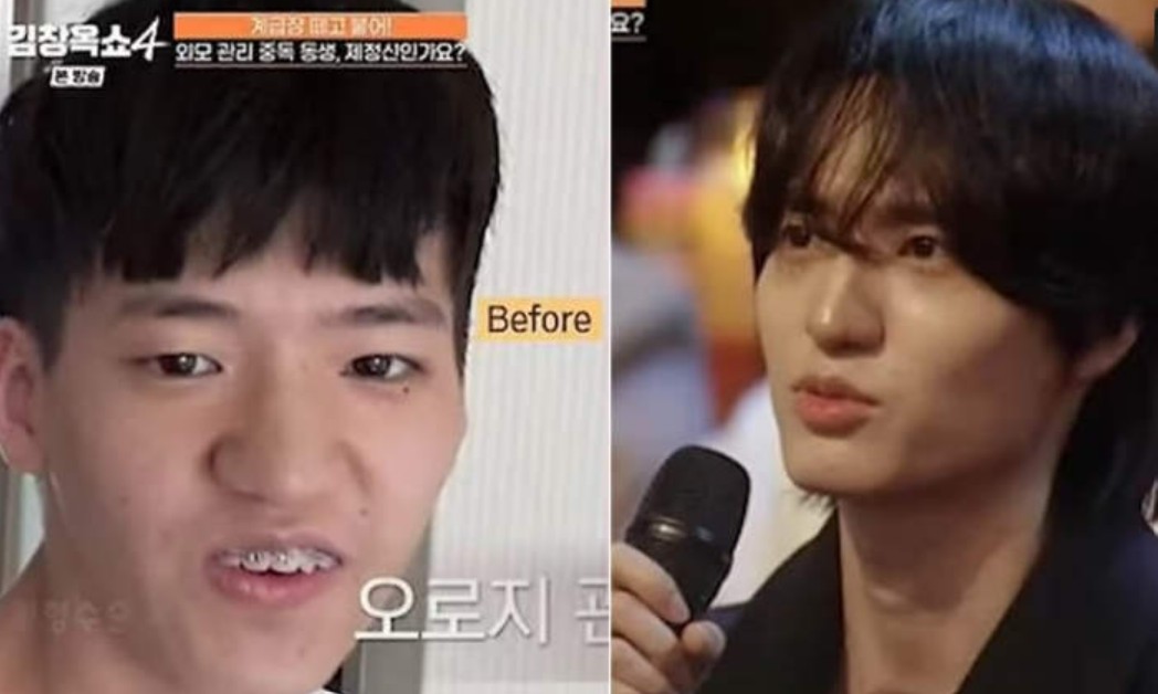 تحول مذهل فى شكل رجل رغم ادعاءه انه لم يجر جراحات تجميل تحول مذهل فى شكل رجل رغم ادعاءه انه لم يجر جراحات تجميل