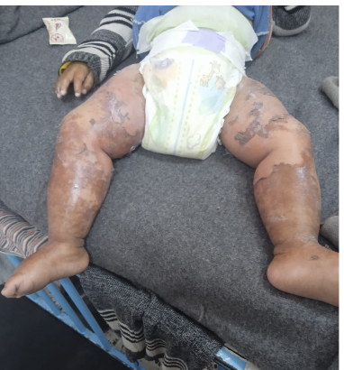 قدم الطفل محمد زنون