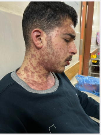 الشاب محمد ضبان