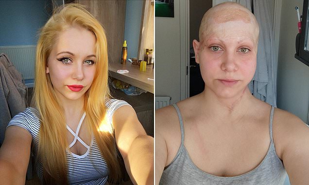 السيدة بعد ما فقدت شعرها