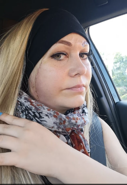 السيدة بعد محاولة العلاج